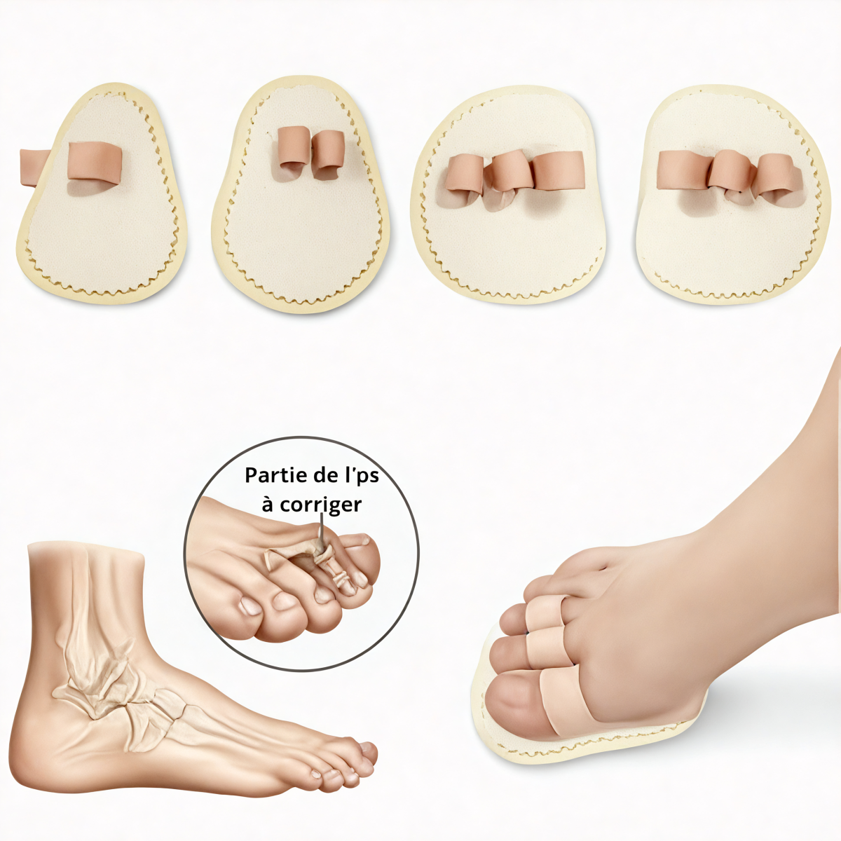 OrthoZen – Redresseur pour Soulager les Orteils en Marteau – Image 2