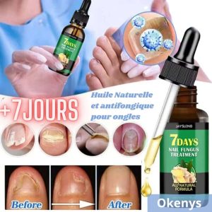 Huile antifongique Okenys: Éradiquez les mycoses et retrouvez des ongles brillants et sains!