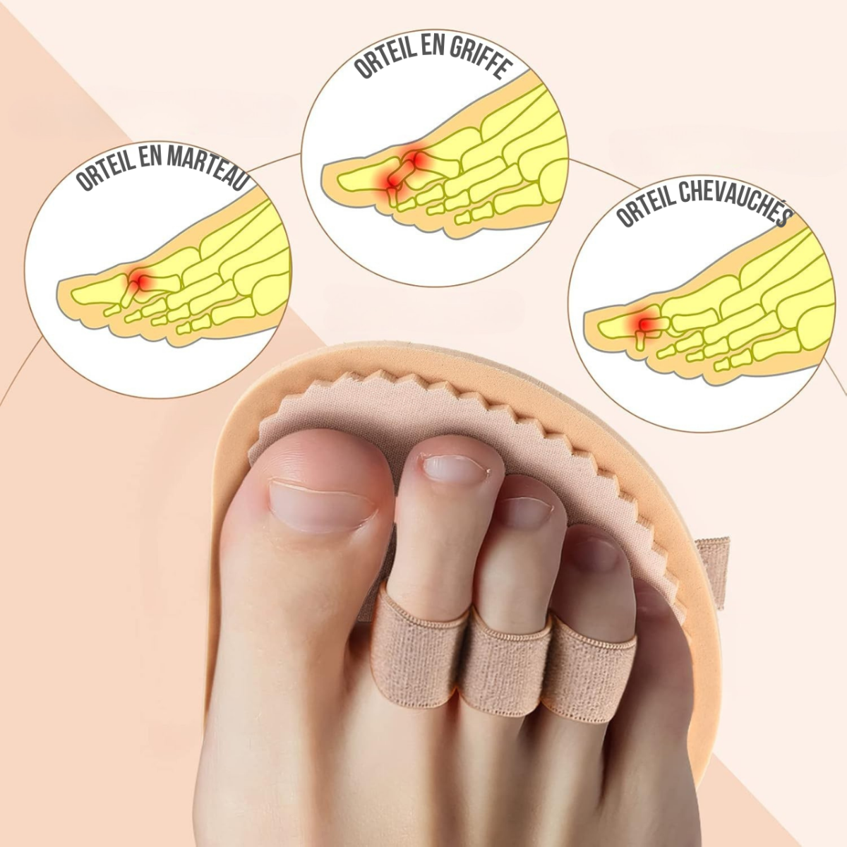 OrthoZen – Redresseur pour Soulager les Orteils en Marteau – Image 3